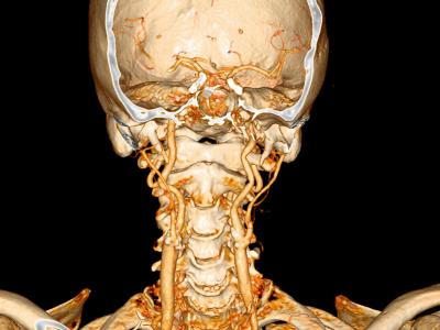 Computed Tomography Image